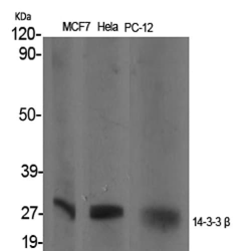 YWHAB / 14-3-3 Beta Antibody (10-90 aa, Internal)