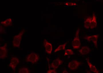 Polyclonal Rabbit anti-Human MRPL51 Antibody (IHC, IF, WB)