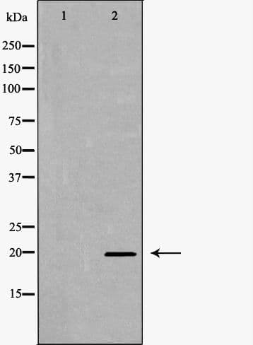 Polyclonal Rabbit anti-Human RHEB Antibody (IHC, IF, WB)