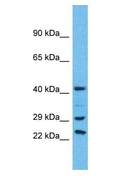 Polyclonal Rabbit anti-Human USP41 Antibody (aa216-265, WB)