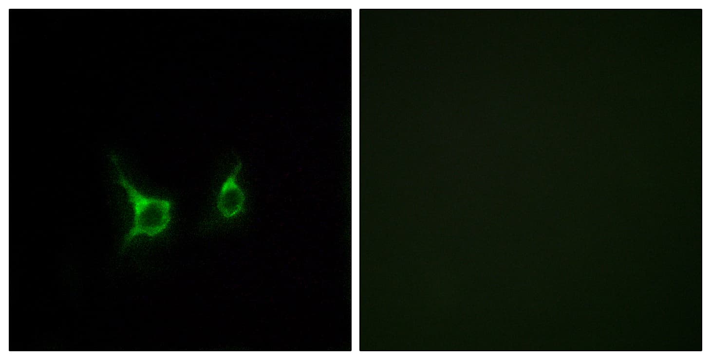IHC-plus™ FFAR2 / GPR43 Antibody (aa271-320)