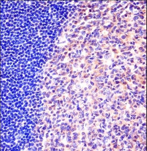 MCM6 Antibody (aa80-109)