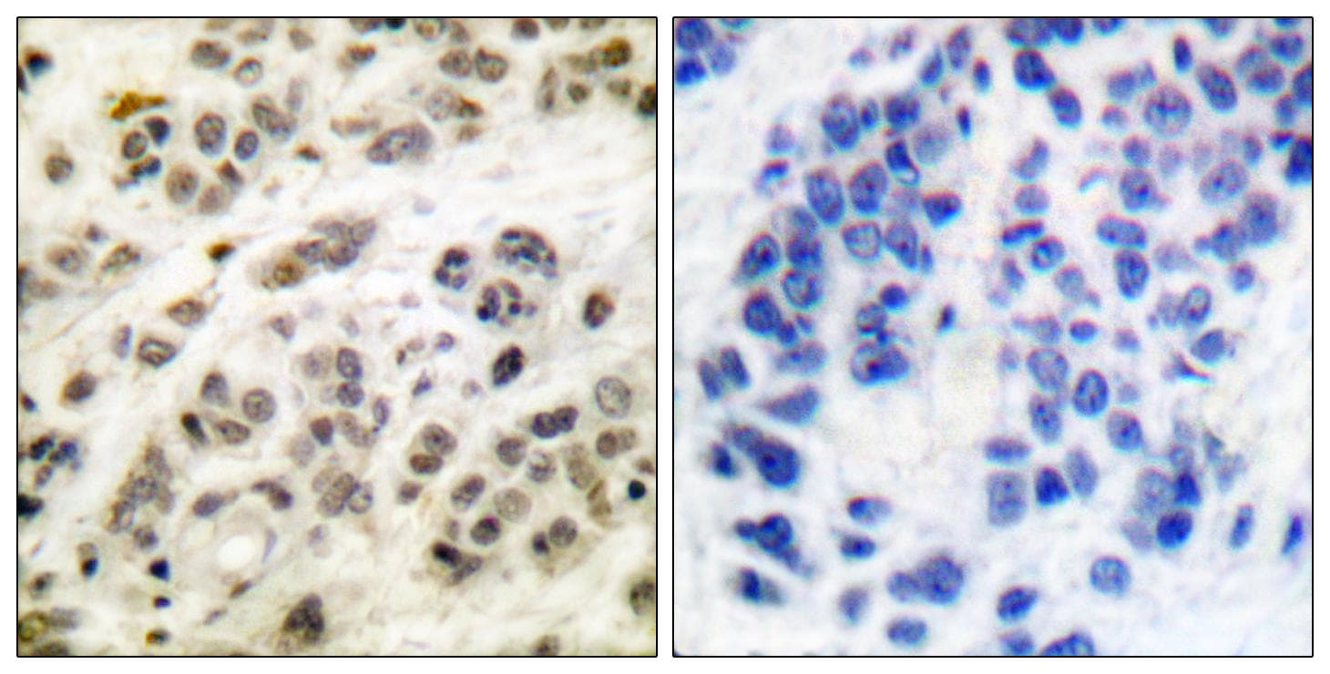 Polyclonal Rabbit anti-Human MYC / c-Myc Antibody (p62, IHC, IF, WB)