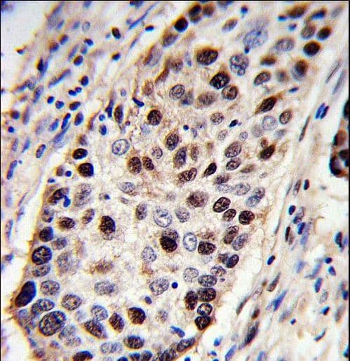 Polyclonal Rabbit anti-Human PCNA Antibody (aa231-261, IHC, IF, WB)
