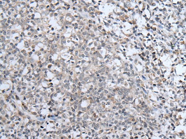 Polyclonal Rabbit anti-Human ABCA6 Antibody (IHC)