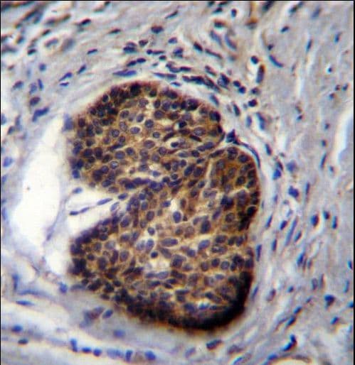 PSCA Antibody (aa56-85)