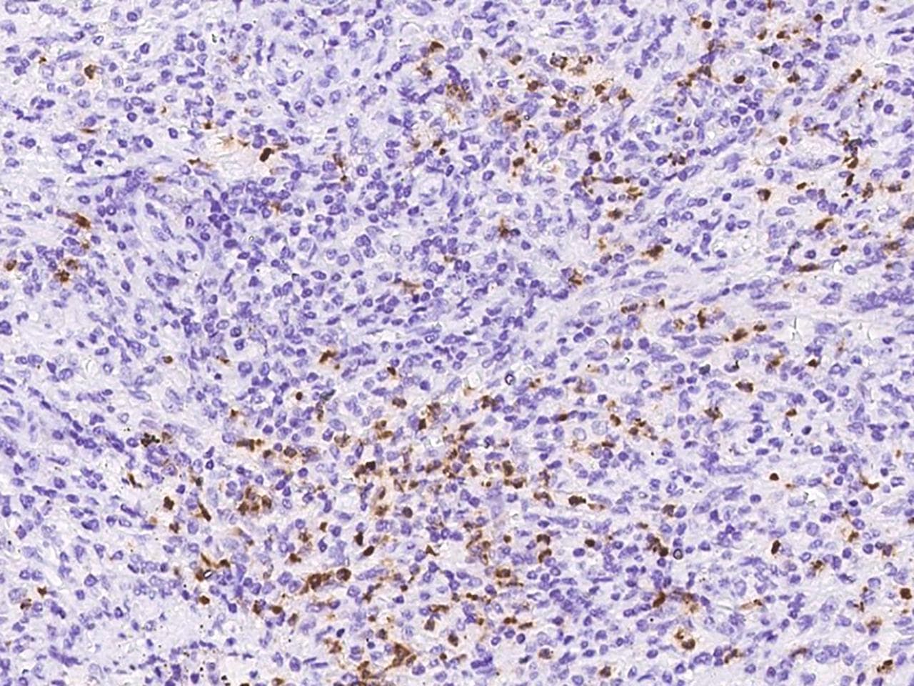 CTSG / Cathepsin G Antibody