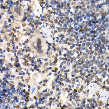 Polyclonal Rabbit anti-Human RAD1 Antibody (IHC, IF, WB)