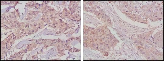 GSK3B / GSK3 Beta Antibody (clone 3D10)