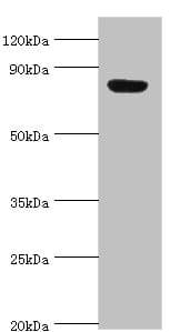 Polyclonal Rabbit anti-Human ARNT2 Antibody (aa440-690, IHC, WB)