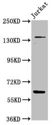 TNKS / Tankyrase Antibody