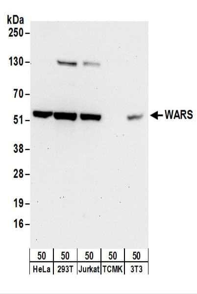 Polyclonal Rabbit anti-Human WARS Antibody (aa1-50, IHC, WB)