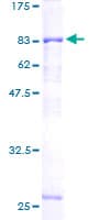 Human HERPUD1 / HERP Protein (Recombinant GST)