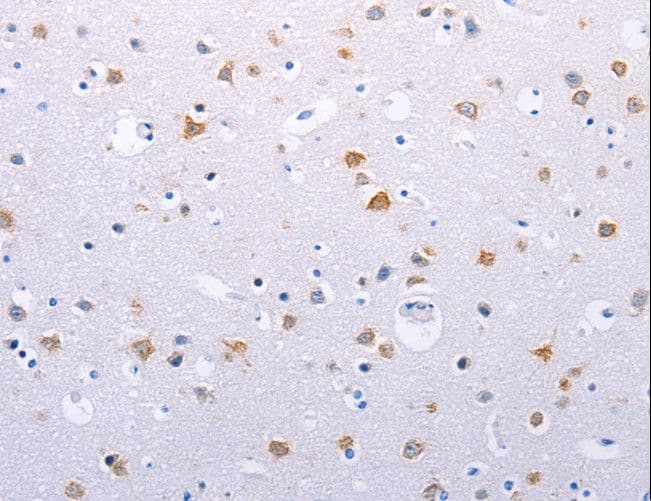 HMGB3 Antibody