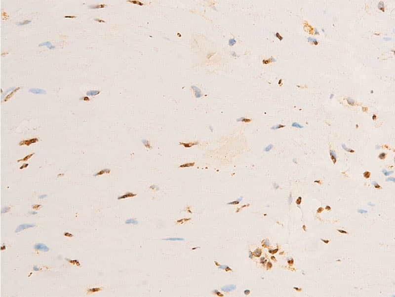 Polyclonal Rabbit anti-Human NTRK1 / TrkA Antibody (phospho-Tyr680,phospho-Tyr681, IHC, WB)