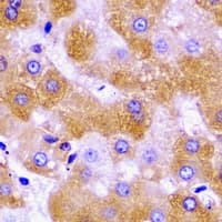 Polyclonal Rabbit anti-Human SCO1 Antibody (IHC, WB)