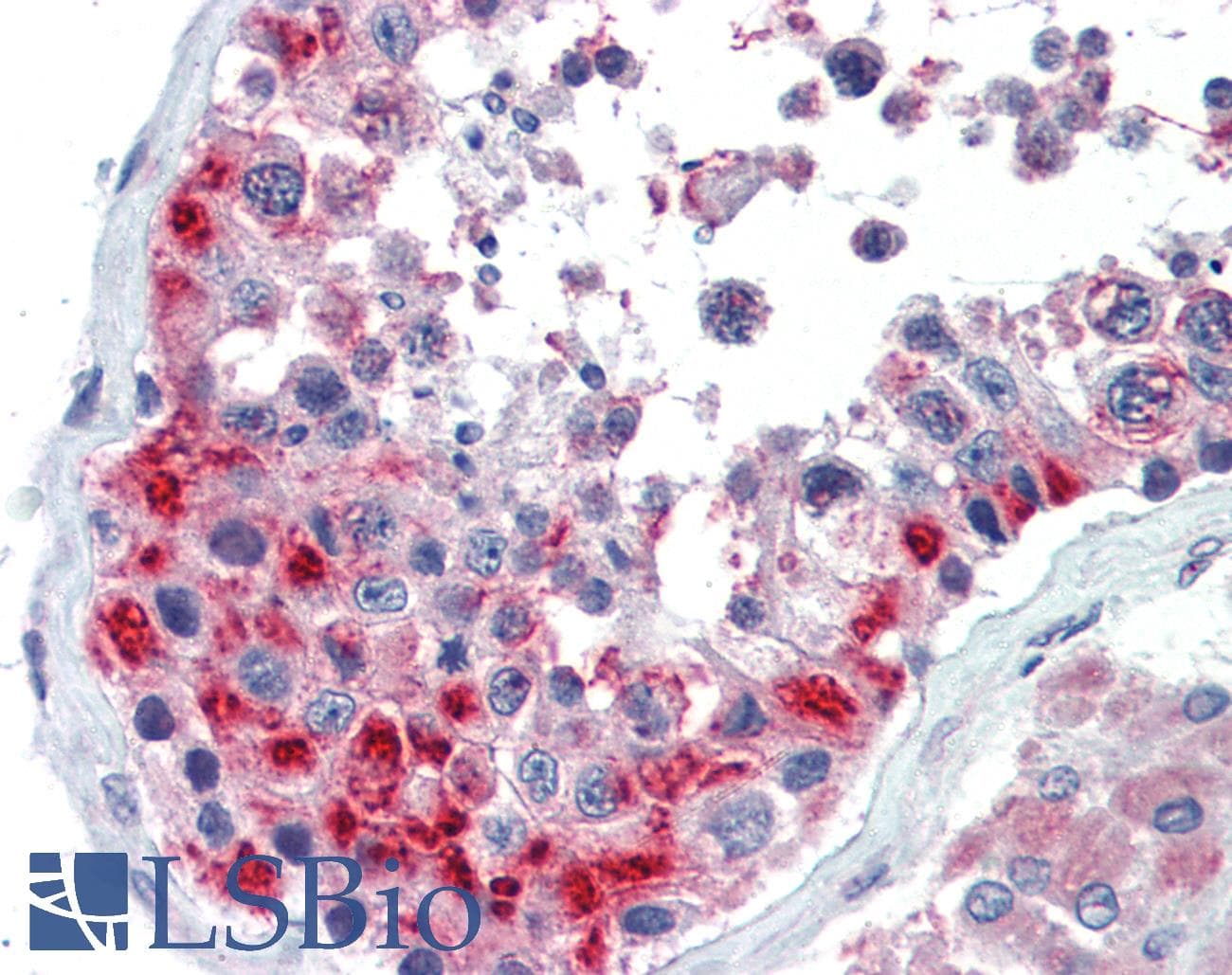 GSC / Goosecoid Antibody (aa35-84)