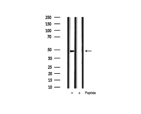 Polyclonal Rabbit anti-Human HDAC3 Antibody (phospho-Ser424, IHC, IF, WB)