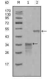 SCGB2A2 / Mammaglobin A Antibody (clone 1G8D6)