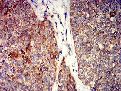 Monoclonal Mouse anti-Human GRIK4 / KA1 Antibody (clone 8H5G5, IHC, WB)