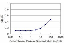Monoclonal Mouse anti-Human RIP4 / ANKRD3 Antibody (clone 2D1, WB)