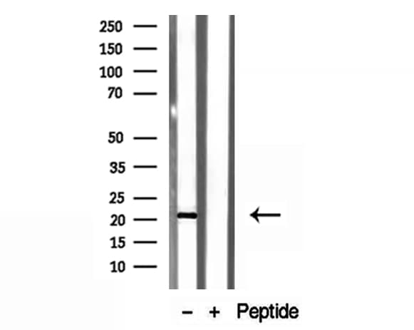 TAF12 Antibody