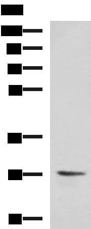 VEGFA / VEGF Antibody