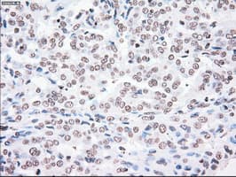 PLK1 / PLK-1 Antibody (clone OTI1D4)