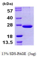 Human PSMB9 Protein (Recombinant His)