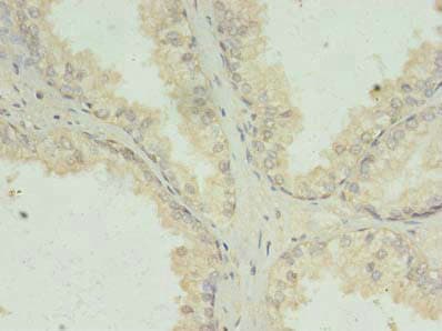 PRKRA / PACT Antibody