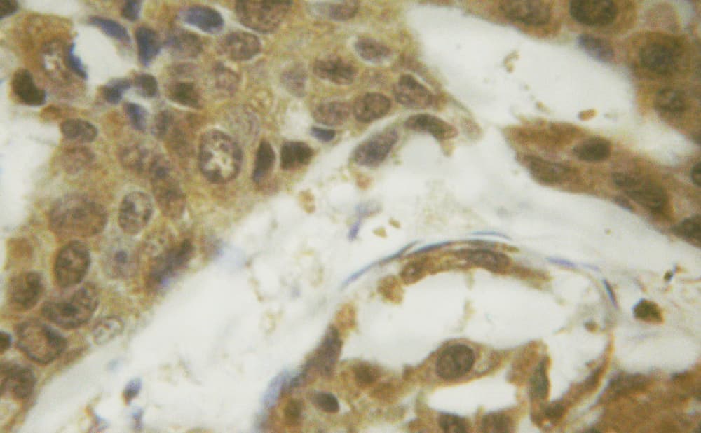 SMAD1 Antibody (phospho-Ser187)