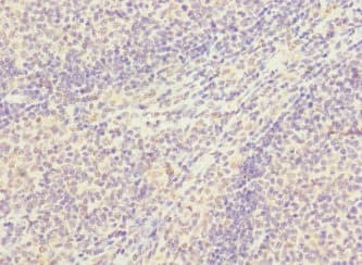 Polyclonal Rabbit anti-Human SNX18 Antibody (IHC, WB)