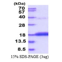Human CDA / Cytidine Deaminase Protein (Recombinant His)