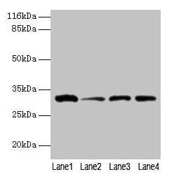 Polyclonal Rabbit anti-Human GSTK1 Antibody (WB)