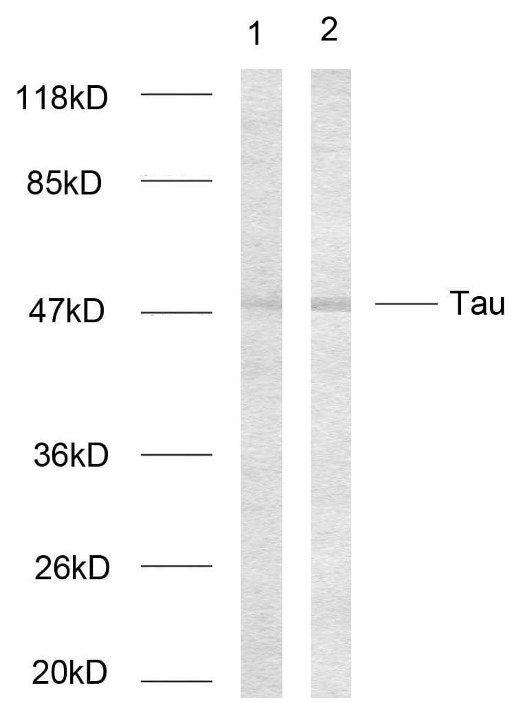 Polyclonal Rabbit anti-Human MAPT / Tau Antibody (phospho-Ser214, WB)