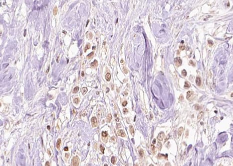 MAPK3 / ERK1 Antibody (phospho-Tyr204)