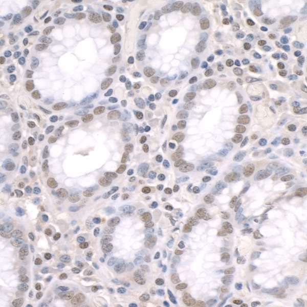ZNF106 / ZFP106 Antibody (aa1833-1883)