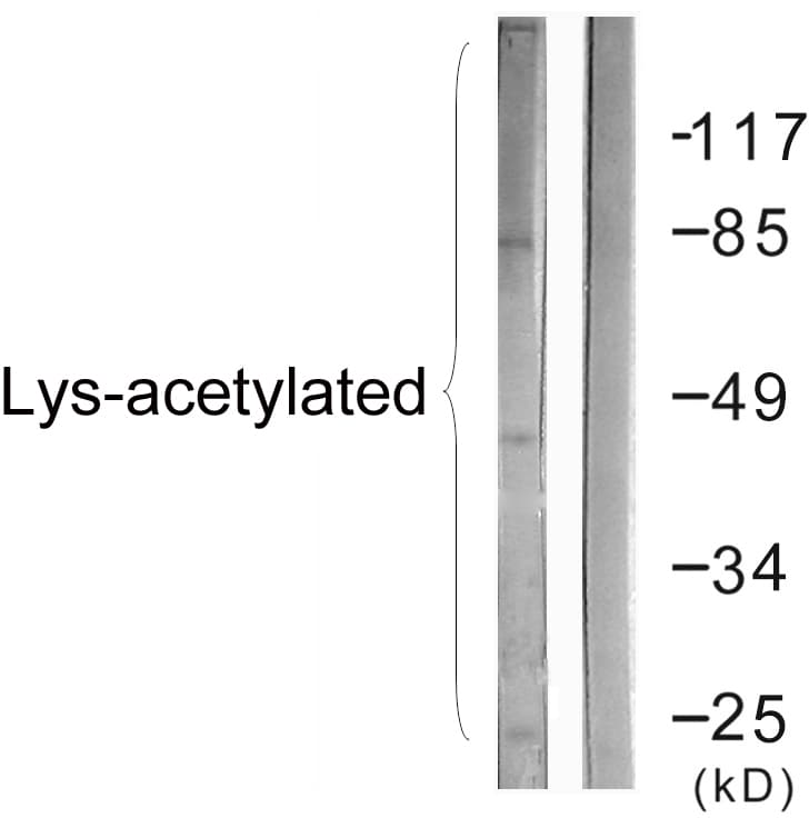Acetyl-Lysine Antibody