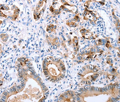 CXCR3 Antibody (aa289-368)