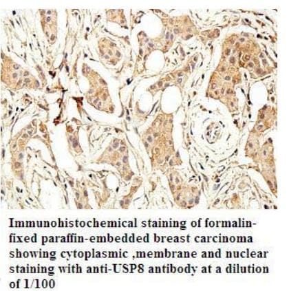 USP8 / UBPY Antibody (aa886-1096)