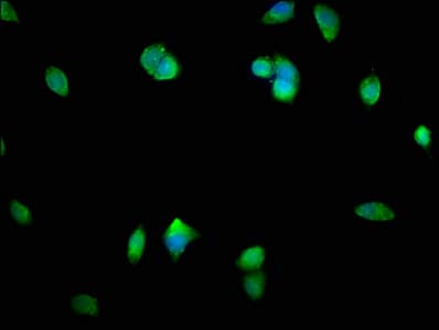 Polyclonal Rabbit anti-Human SMAD1 Antibody (IHC, IF)