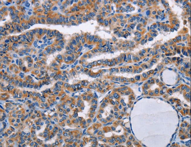 Polyclonal Rabbit anti-Human STRADB / ALS2CR2 Antibody (IHC, WB)