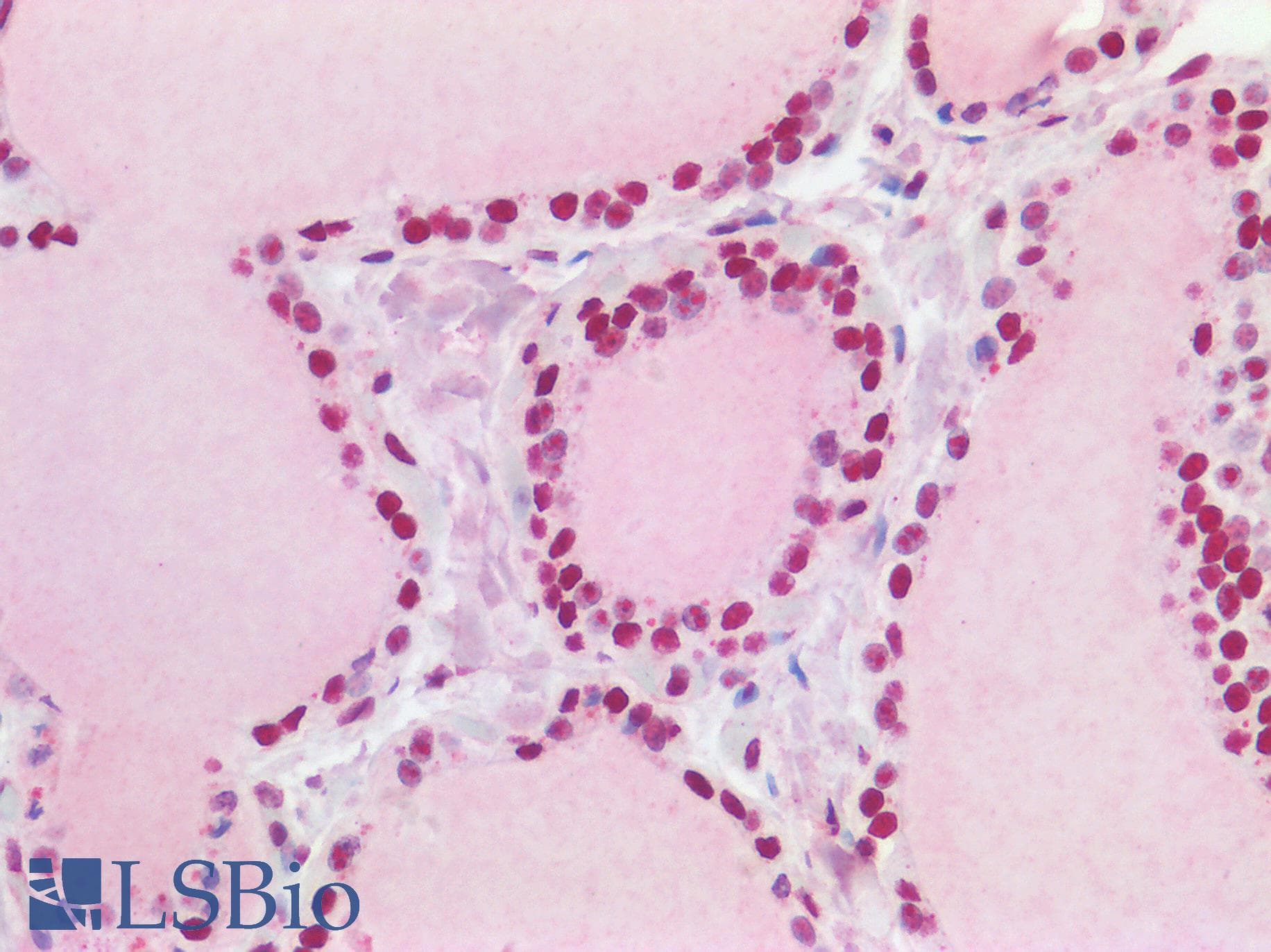 IHC-plus™ Polyclonal Goat anti-Human TP53BP1 / 53BP1 Antibody (aa350-400, IHC)