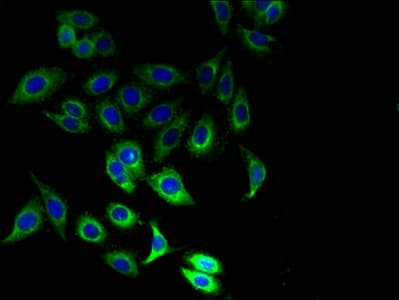 CD225 / IFITM1 Antibody