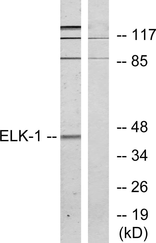 Polyclonal Rabbit anti-Human ELK1 Antibody (aa356-405, IHC, WB)