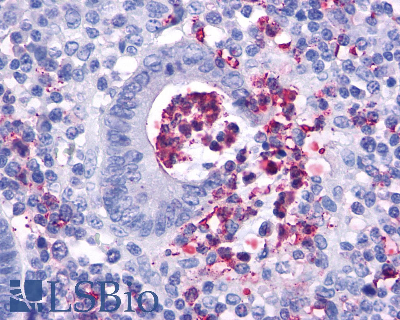 PathPlus™ FPR2 / FPRL1 Antibody (C-Terminus)