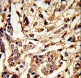Polyclonal Rabbit anti-Human GALT Antibody (aa344-373, IHC, WB)