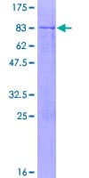 Human GPT2 / ALT2 Protein (Recombinant GST)
