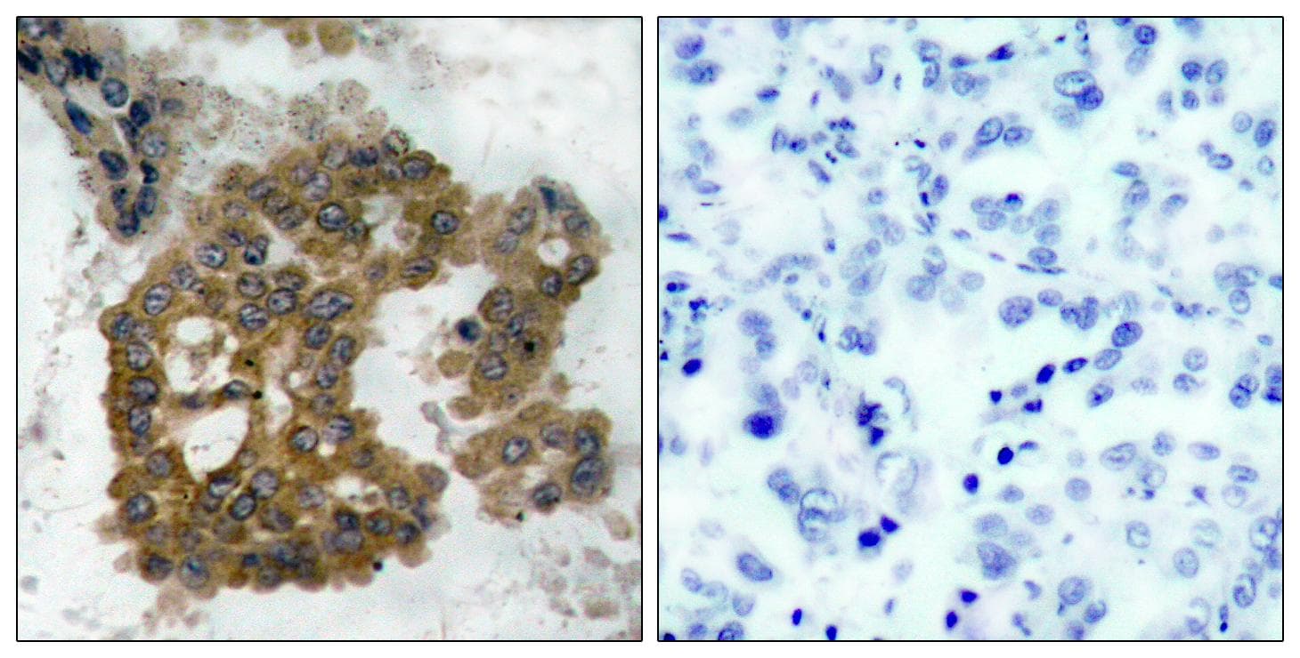 AKT2 Antibody (phospho-Ser474)