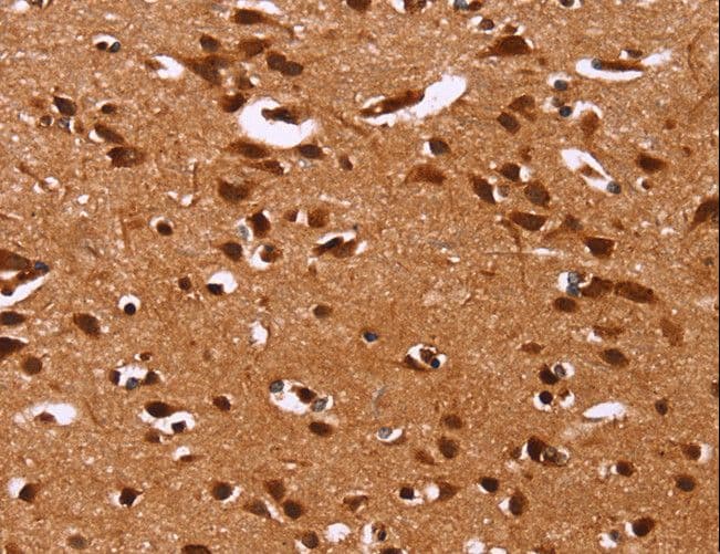 HRK / HARAKIRI Antibody